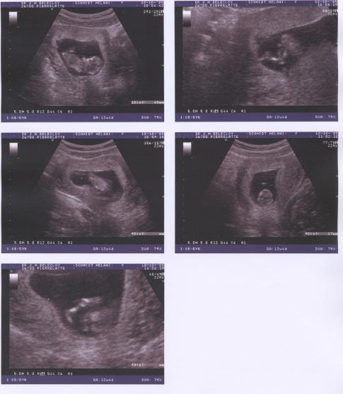 deuxieme main rencontre