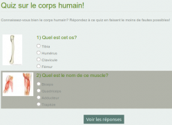 Widget afficher quiz