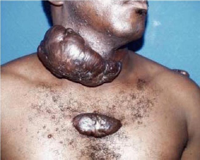 cicatrices sur le visage
