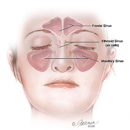Nez et sinus - Troubles du nez, de la gorge et de l'oreille