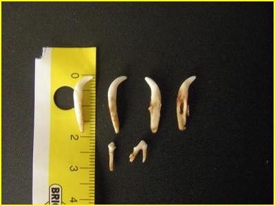 Différences des dents et des racines