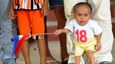 Le plus petit homme au monde ( Junrey Balawing  )