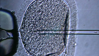 Des jumelles nées après congélation ultra-rapide d'embryons