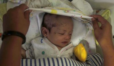 Miracle d'un bébé, survivant du tsunami en Indonésie