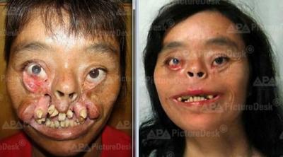 Insolite : Kang Sangmu a vécu 36 ans sans visage... 